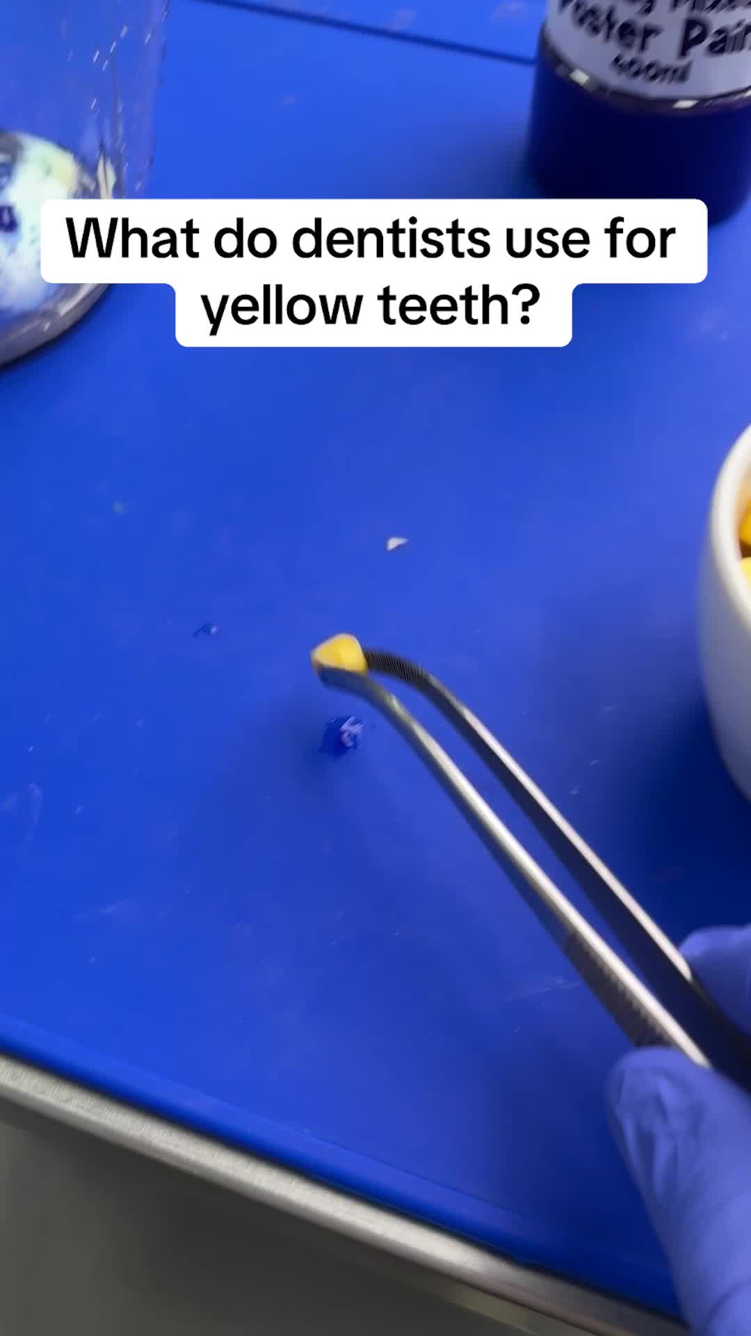 What do dentists use for yellow teeth?